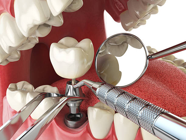 Best Emergency Dental Care for Broken or Chipped Teeth in Sugarcreek, PA